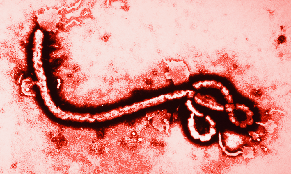 Ebola Prevention